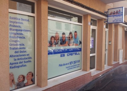 Consulta dental Es Castell